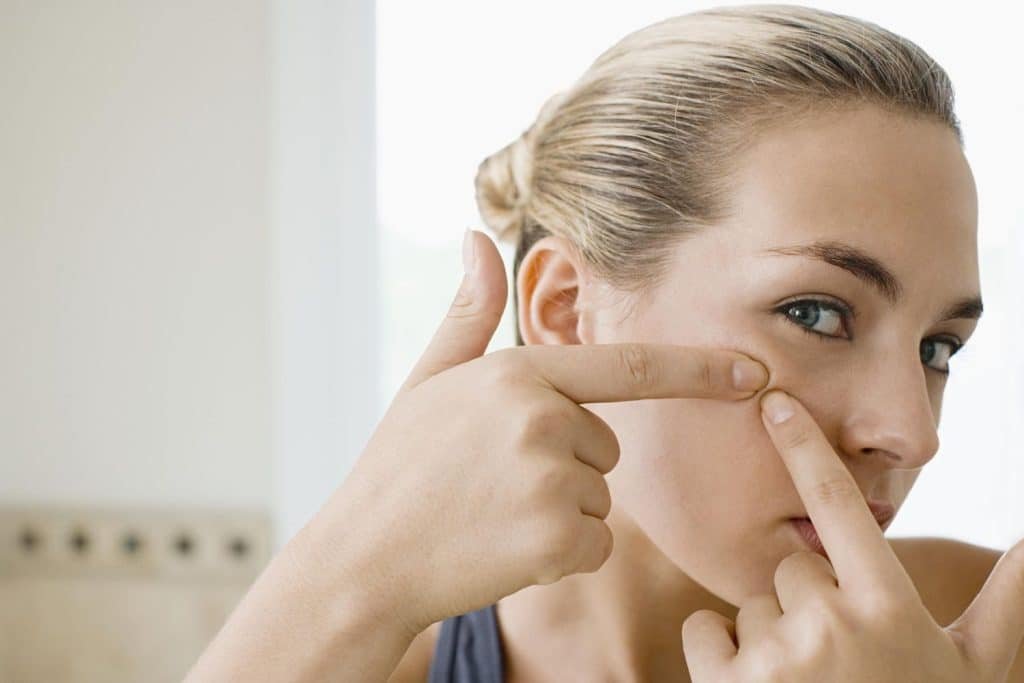 Learn To Resist The Urge To Pop Every Pimple